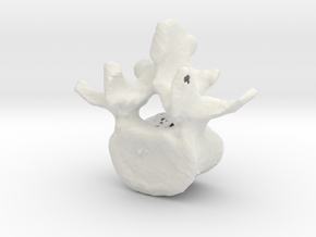 L4 lumbar vertebral body in White Natural Versatile Plastic