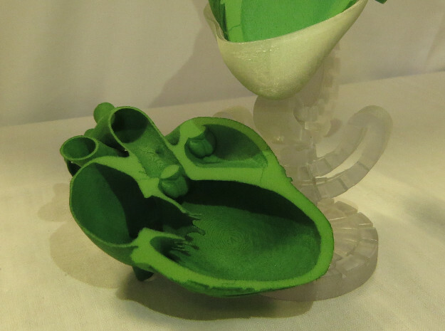 Parasternal long axis 2 in Green Processed Versatile Plastic