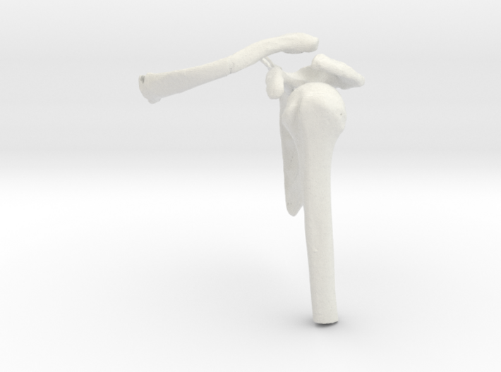 Shoulder Fracture - Scapula and Clavicle Fracture 3d printed