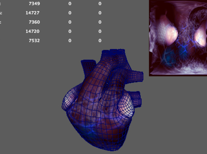 Human Heart 3d printed