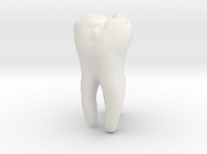 Molar Tooth 200mm-1 ---Backenzahn 200mm-1 3d printed