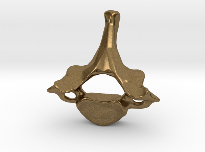 Neck vertebra - C7 3d printed