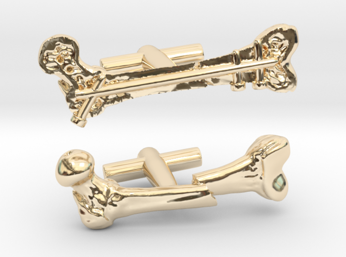 Femur Fracture and Fixation Cufflinks 3d printed