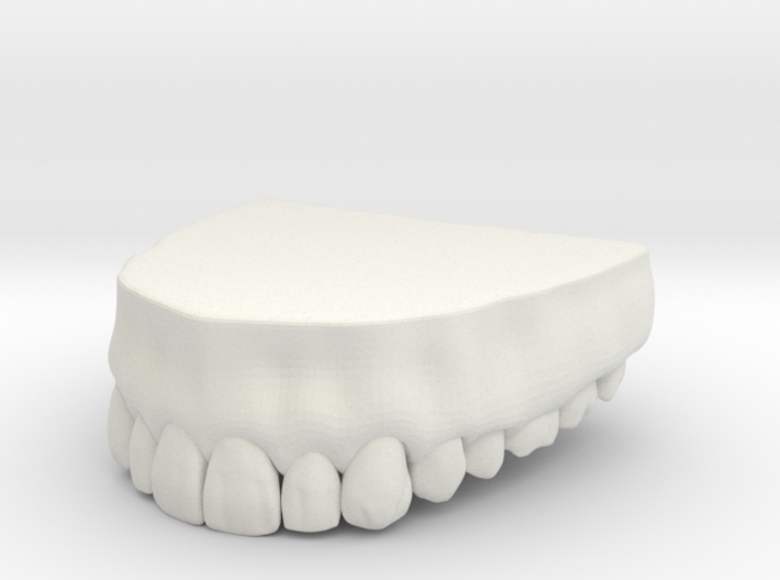 3D Teeth top 3d printed