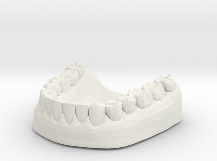 3D Teeth lower 3d printed