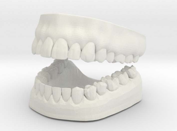 3D Teeth and Gum 3d printed