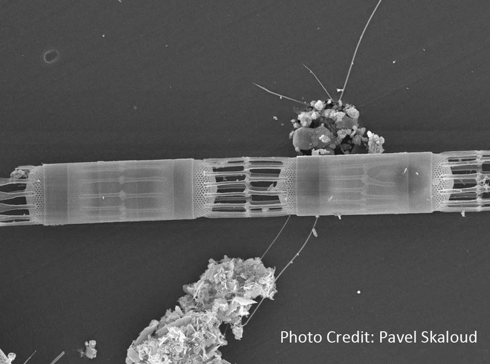 Skeletonema Diatom Bracelet  3d printed Skeletonema micrograph by Pavel Skaloud