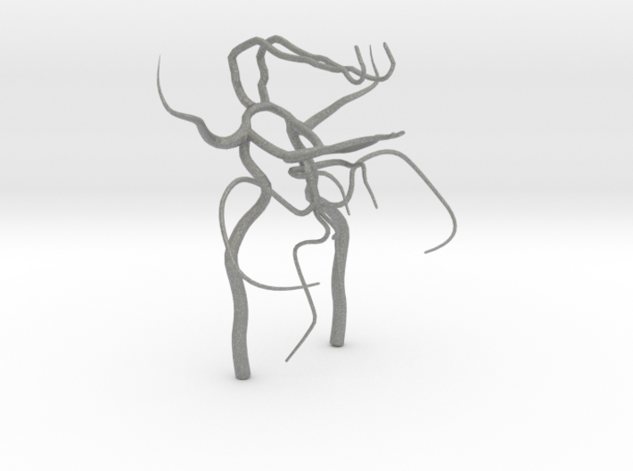 Circle of willis - brain vasculature 3d model 3d printed