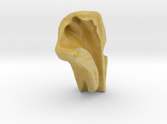 Subject 0.e | Right Pharynx (Before) 3d printed