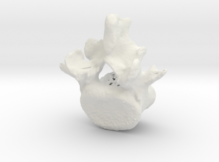 L5 lumbar vertebral body 3d printed