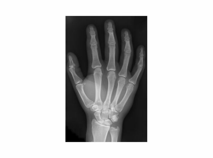Hand Keychain Charm 3d printed X-ray of human hand, dorsal view
