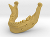 Subject 0.h | Mandible (After) 3d printed 